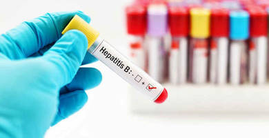 Can I get a hair transplant if I have hepatitis B?