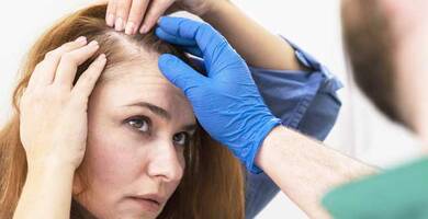 الصلع الذكوري النمطي عند النساء: ما هو العلاج؟