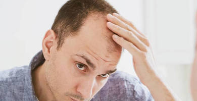 الشعر الاصطناعي أم عملية زراعة الشعر: أيهما الأفضل؟