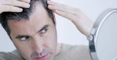 لماذا يحدث تساقط الشعر المزروع بعد 10 أيام؟