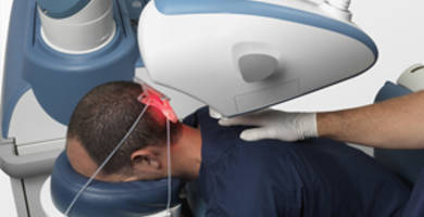 زراعة الشعر باستخدام الروبوت، بين الحقيقة و الترويج التجاري!