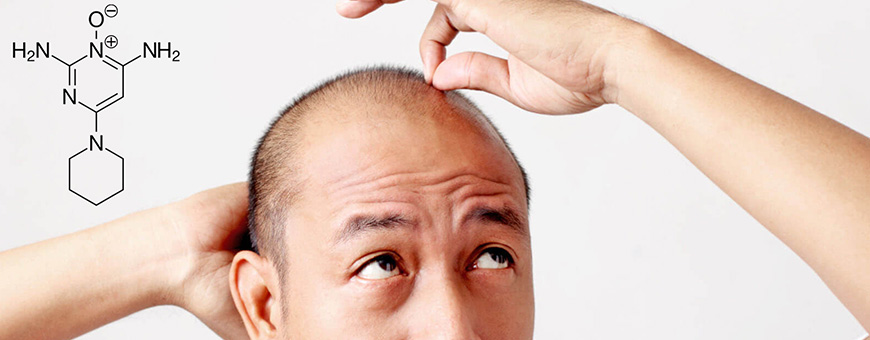 Le Minoxidil, ralentit la chute de cheveux ?| Clinicana