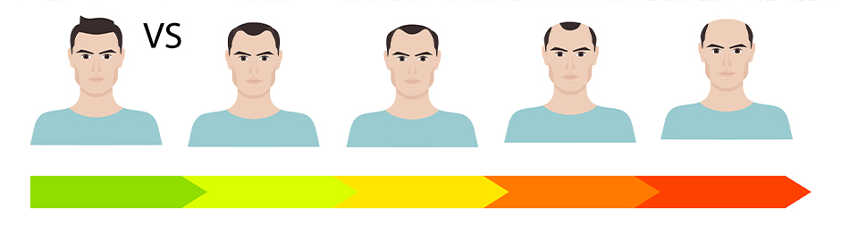 WHAT IS THE BEST TIME TO PERFORM A HAIR TRANSPLANT IN TURKEY?