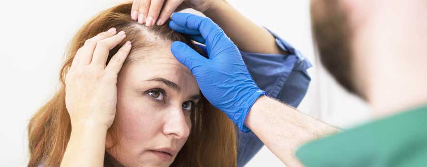 الصلع الذكوري النمطي عند النساء: ما هو العلاج؟